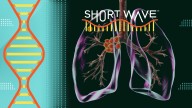 Medical experts can cure tuberculosis. Why haven’t we eradicated it? : Short Wave : NPR