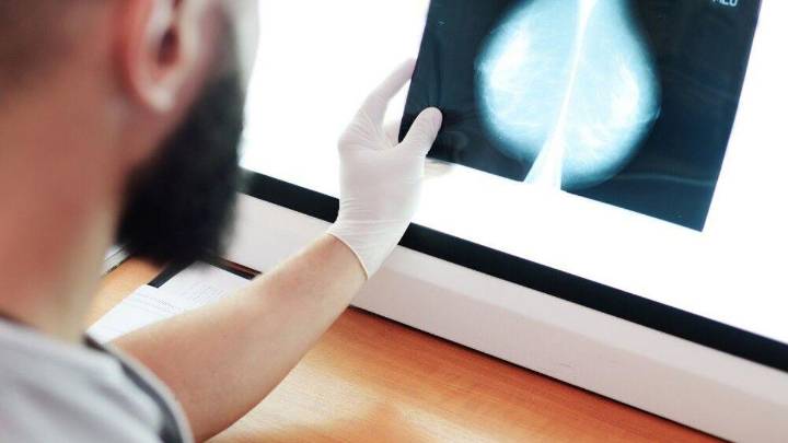 La Fiscalía investiga la denuncia del Defensor del Paciente de Andalucía por los fallos en el cribado del cáncer de mama en la comunidad