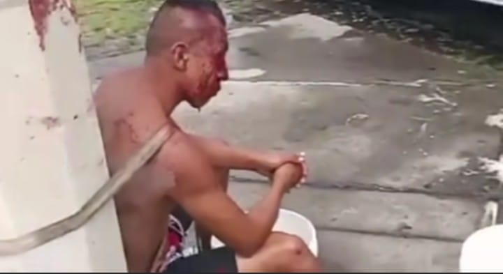 DETENIDO POR DESCUARTIZAR DOS CANES EN HÉROES CHALCO