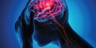 UofL y UofL Health investigan nuevas vías para el tratamiento de accidentes cerebrovasculares isquémicos