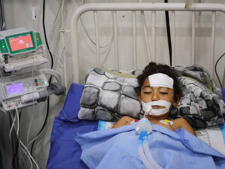 Bomb in Gaza’s rubble wounds twins who thought it was a toy