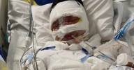 Community rallies for teen burn victim in Coonabarabran