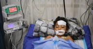A bomb in Gaza's rubble wounds twins who thought it was a toy