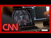 Hear why Alzheimer’s researchers are studying the brains of London cab drivers