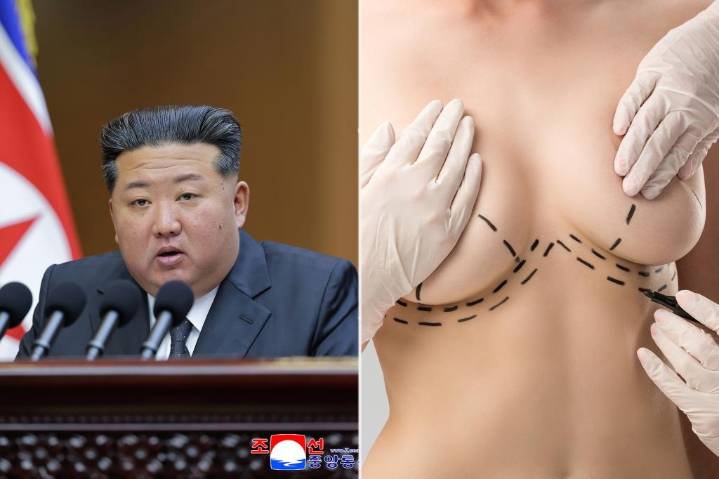 Kim Jong Un ordered emergency crackdown on 'anti-socialist' breast implantsurgeries: report