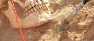 El ADN saca a la luz qué diezmó a las tropas de Napoleón