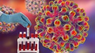STD Cases Have Declined In US Adults, But Syphilis Continue To Rise In Newborns