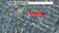 Driver stops car, gets out and assaults rabbi in Bergenfield, New Jersey, police say