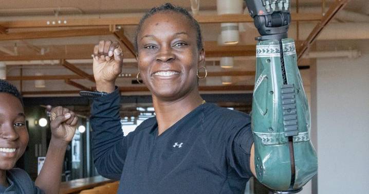 Vet who survived grenade attack first to get ‘Call of Duty’ bionic arm