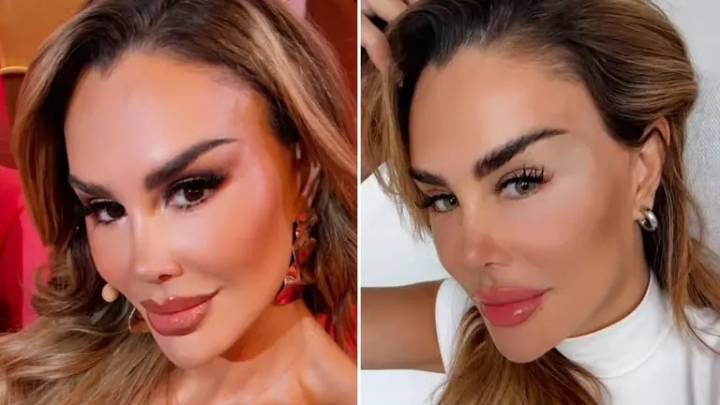 Ninel Conde se sometió a una ciruguia para cambiar el color de sus ojos: ¿Cuánto pagó? (+Video) 30 de octubre de 2025 | Espectáculos El procedimiento estético busca modificar el tono natural del iris