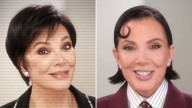 'The Kardashians' Season 7 Shows Before and After of Kris Jenner's Facelift
