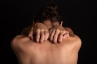 Can you catch shingles? A GP explains what people get wrong about this common virus