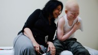 Aid group faces hurdles in bringing severely injured children to the U.S. 'to give them hope'