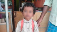 Anganwadi assistant burns child’s face in Soraba village, parents lodge complaint