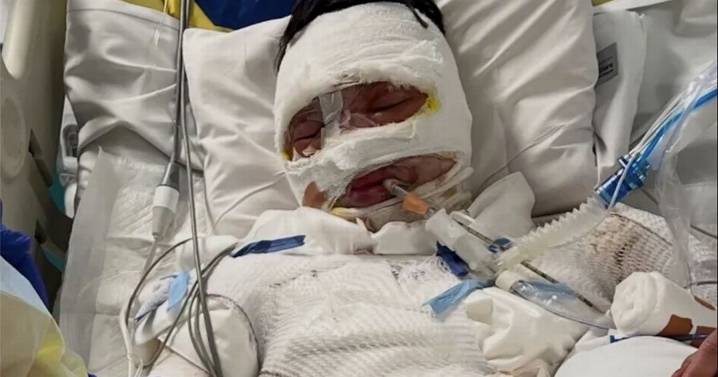 Teen fighting for life in hospital after being 'doused in petrol and set alight'