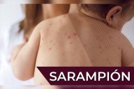 Sarampión, presente ya en seis municipios