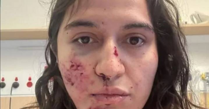 Horror as mad magpie attacks woman and leaves her with broken neck