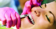 The straight truth on orthodontic care
