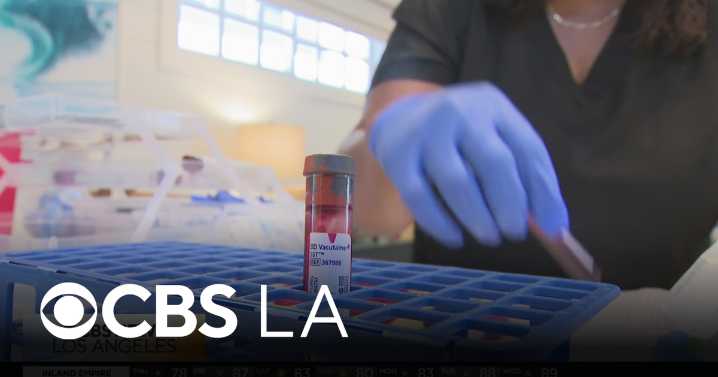 How a series of blood tests is shedding light on Alzheimer's