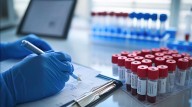 Avance contra la epilepsia: científicos argentinos identificaron biomarcadores que pueden ayudar al diagnóstico