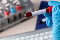 Five children test HIV positive after blood transfusion in Jharkhand; Civil Surgeon suspended