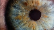 Queratocono: el peligro de frotarse los ojos, que puede tardar una década en dar la cara