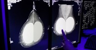 ¿Qué sabemos del Laboratorio Nacional de Inteligencia Artificial y cómo ayudaría para detectar el cáncer?