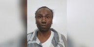 Healthcare worker accused of burning patient with barbecue lighter