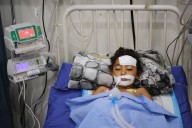 A bomb in Gaza’s rubble wounds twins who thought it was a toy
