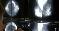 Rev. Susan Smith shares story of living with breast cancer