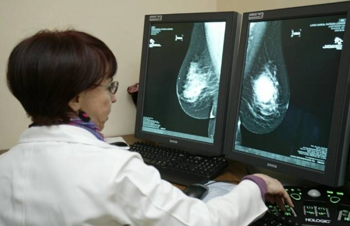 Campaña de la Ssa va por 90% de detección oportuna de cáncer en mujeres