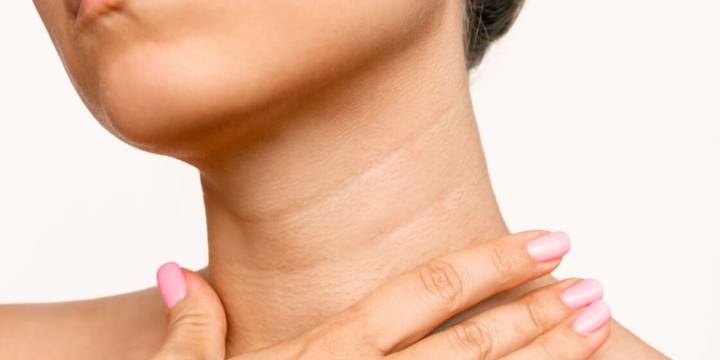 Cómo reducir las arrugas del cuello y mejorar la firmeza de la piel de forma natural