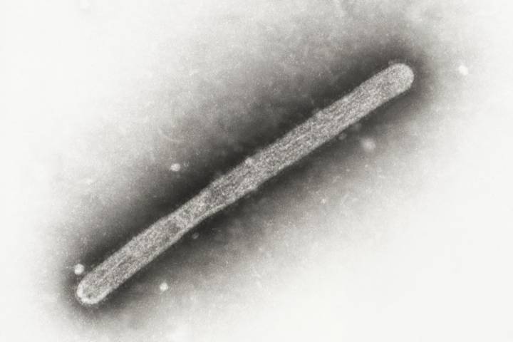 First flu death of 2025-26 season announced in North Carolina: NCDHHS