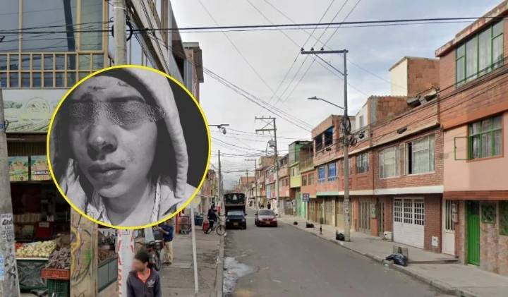 A una vendedora de arepas y a su pareja les dieron una golpiza por una deuda ajena
