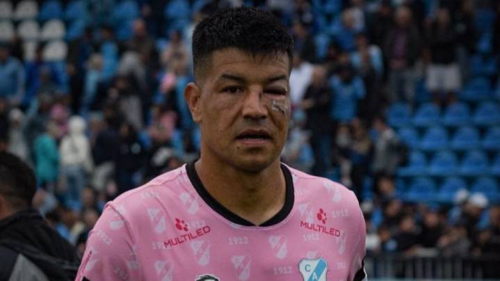 Temperley: Bruno Duarte fue operado con éxito tras sufrir una fractura facial