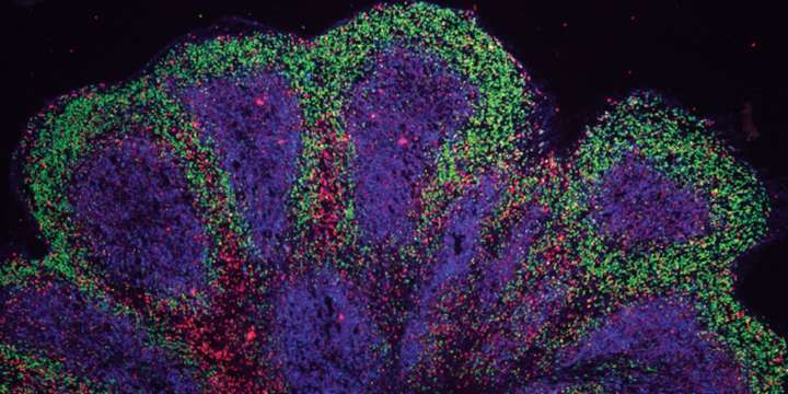 Científicos de Stanford logran fabricar en laboratorio miles de mini cerebros mediante un aditivo alimentario común