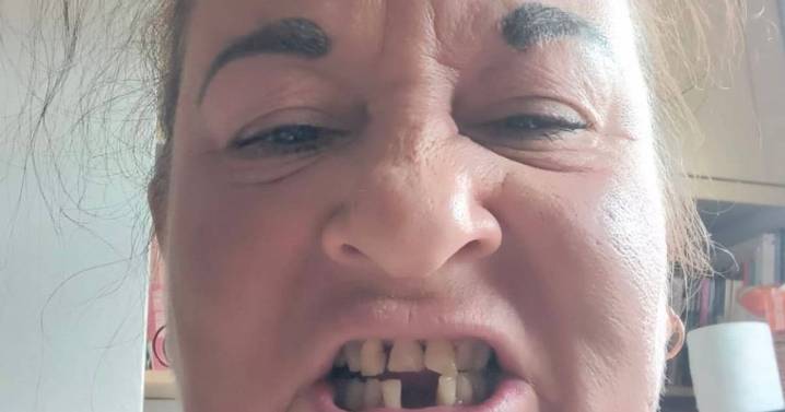 'I work for the NHS but they wouldn't treat my condition, so I flew to Croatia'