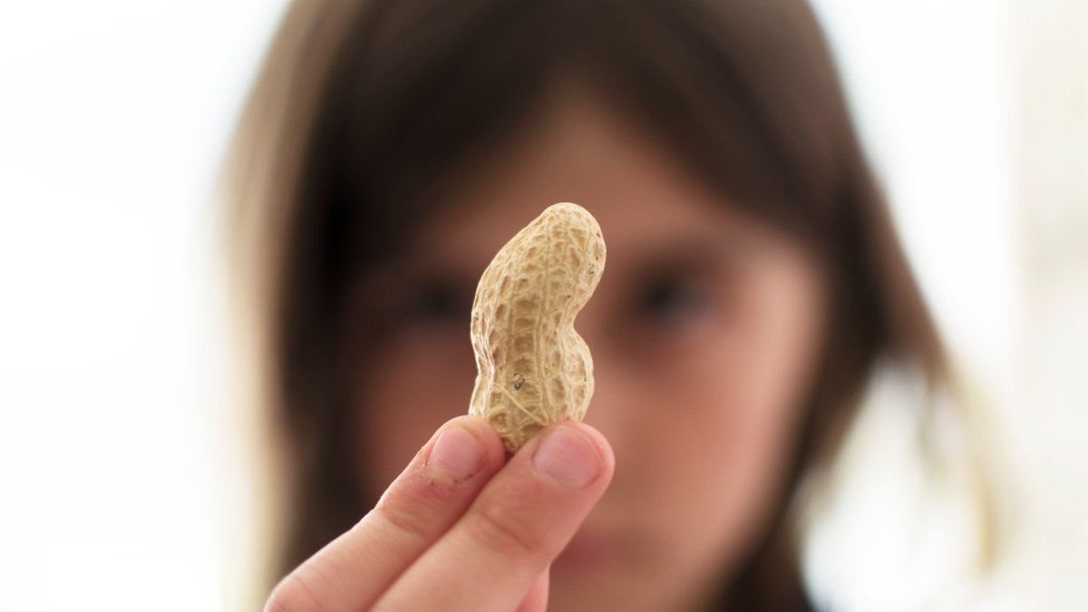 Feeding babies peanuts early prevented 60,000 allergy cases