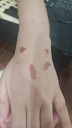 Una niña sufrió quemaduras por glitter: denuncian falta de control nacional