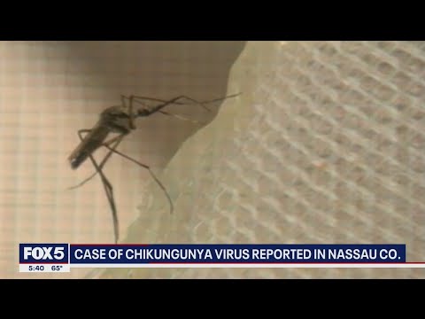 Case of chikungunya virus reported in Nassau County
