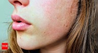 8 tips to prevent dry skin in winter and keep it smooth all season