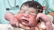 Baby Comes Out Of Mom Clutching Her Copper-T Contraceptive Like A Trophy!