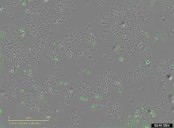 Descubren un mecanismo bacteriano que podría destruir células tumorales