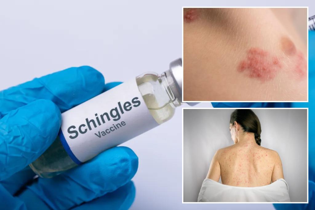 Shingles vaccine connected to significant health benefits, experts say