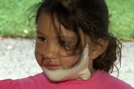 Dog Euthanized After Viciously Attacking 4-Year-Old Girl, Her Mother in Ohio