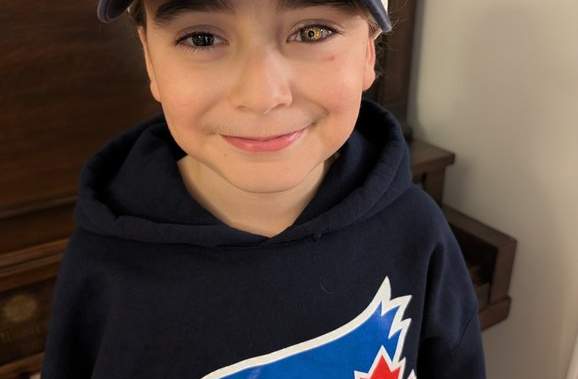 Boy’s prosthetic eye shows love for Jays