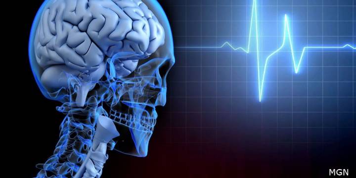 Kim Kardashian’s brain aneurysm highlights silent health threat