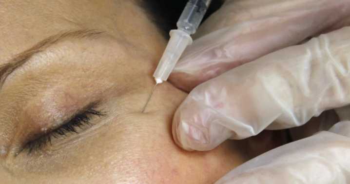 Two hospitalized in Louisiana after counterfeit Botox injections, health department warns