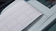 Advierten por “corazón frágil”; aumentan infartos en personas jóvenes de Coahuila