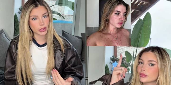 Flavia Laos confiesa que padece enfermedad incurable: “Mi cuerpo comenzó a hablar por sí solo”